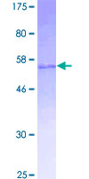 ab159541 on a 12.5% SDS-PAGE stained with Coomassie Blue.