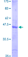 ab158843 on a 12.5% SDS-PAGE stained with Coomassie Blue.