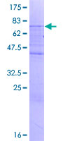 ab163863 on a 12.5% SDS-PAGE stained with Coomassie Blue.