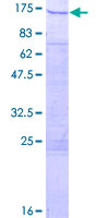 ab162336 on a 12.5% SDS-PAGE stained with Coomassie Blue.