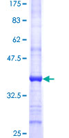ab162337 on a 12.5% SDS-PAGE stained with Coomassie Blue.