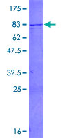 ab159543 on a 12.5% SDS-PAGE stained with Coomassie Blue.
