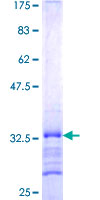 ab159544 on a 12.5% SDS-PAGE stained with Coomassie Blue.