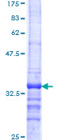ab159545 on a 12.5% SDS-PAGE stained with Coomassie Blue.