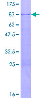 ab152695 on a 12.5% SDS-PAGE stained with Coomassie Blue.