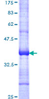 ab152696 on a 12.5% SDS-PAGE stained with Coomassie Blue.