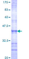 ab162088 on a 12.5% SDS-PAGE stained with Coomassie Blue.