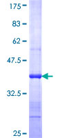 ab153101 on a 12.5% SDS-PAGE stained with Coomassie Blue.