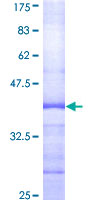ab164073 on a 12.5% SDS-PAGE stained with Coomassie Blue.