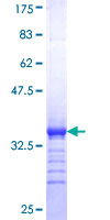 ab163774 on a 12.5% SDS-PAGE stained with Coomassie Blue.