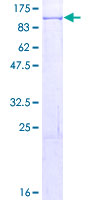 ab153442 on a 12.5% SDS-PAGE stained with Coomassie Blue.