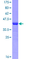 ab153443 on a 12.5% SDS-PAGE stained with Coomassie Blue.