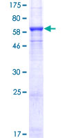 ab153490 on a 12.5% SDS-PAGE stained with Coomassie Blue.