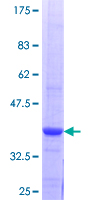 ab153491 on a 12.5% SDS-PAGE stained with Coomassie Blue.