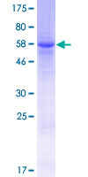 ab153068 on a 12.5% SDS-PAGE stained with Coomassie Blue.