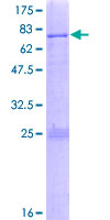 ab159551 on a 12.5% SDS-PAGE stained with Coomassie Blue.
