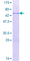 ab159552 on a 12.5% SDS-PAGE stained with Coomassie Blue.