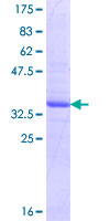 ab159553 on a 12.5% SDS-PAGE stained with Coomassie Blue.