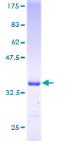 ab160937 on a 12.5% SDS-PAGE stained with Coomassie Blue.