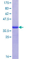 ab153280 on a 12.5% SDS-PAGE stained with Coomassie Blue.