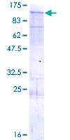 ab165600 on a 12.5% SDS-PAGE stained with Coomassie Blue.