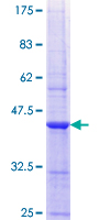 ab165601 on a 12.5% SDS-PAGE stained with Coomassie Blue.