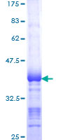 ab153212 on a 12.5% SDS-PAGE stained with Coomassie Blue.