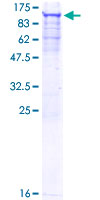ab153386 on a 12.5% SDS-PAGE stained with Coomassie Blue.