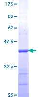 ab153387 on a 12.5% SDS-PAGE stained with Coomassie Blue.