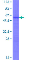 ab161245 on a 12.5% SDS-PAGE stained with Coomassie Blue.