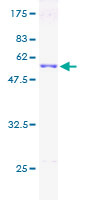 ab159554 on a 12.5% SDS-PAGE stained with Coomassie Blue.
