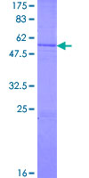 ab159555 on a 12.5% SDS-PAGE stained with Coomassie Blue.