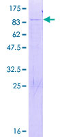 ab161169 on a 12.5% SDS-PAGE stained with Coomassie Blue.