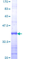 ab163532 on a 12.5% SDS-PAGE stained with Coomassie Blue.