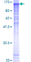 ab166488 on a 12.5% SDS-PAGE stained with Coomassie Blue.