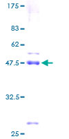 ab162186 on a 12.5% SDS-PAGE stained with Coomassie Blue.