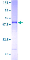 ab164350 on a 12.5% SDS-PAGE stained with Coomassie Blue.
