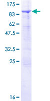 ab166081 on a 12.5% SDS-PAGE stained with Coomassie Blue.