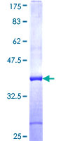 ab166082 on a 12.5% SDS-PAGE stained with Coomassie Blue.