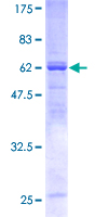ab162531 on a 12.5% SDS-PAGE stained with Coomassie Blue.