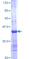 ab162532 on a 12.5% SDS-PAGE stained with Coomassie Blue.