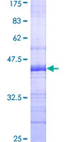 ab162248 on a 12.5% SDS-PAGE stained with Coomassie Blue.