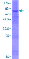 ab160025 on a 12.5% SDS-PAGE stained with Coomassie Blue.
