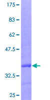 ab152922 on a 12.5% SDS-PAGE stained with Coomassie Blue.