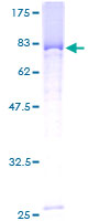 ab153591 on a 12.5% SDS-PAGE stained with Coomassie Blue.