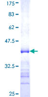 ab160597 on a 12.5% SDS-PAGE stained with Coomassie Blue.