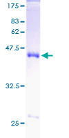 ab159559 on a 12.5% SDS-PAGE stained with Coomassie Blue.