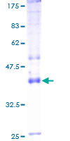 ab157925 on a 12.5% SDS-PAGE stained with Coomassie Blue.