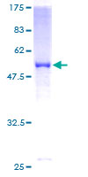 ab162901 on a 12.5% SDS-PAGE stained with Coomassie Blue.
