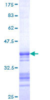 ab159587 on a 12.5% SDS-PAGE stained with Coomassie Blue.